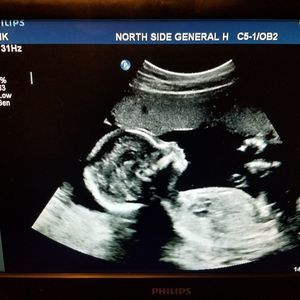 Meet your Posher, Ember